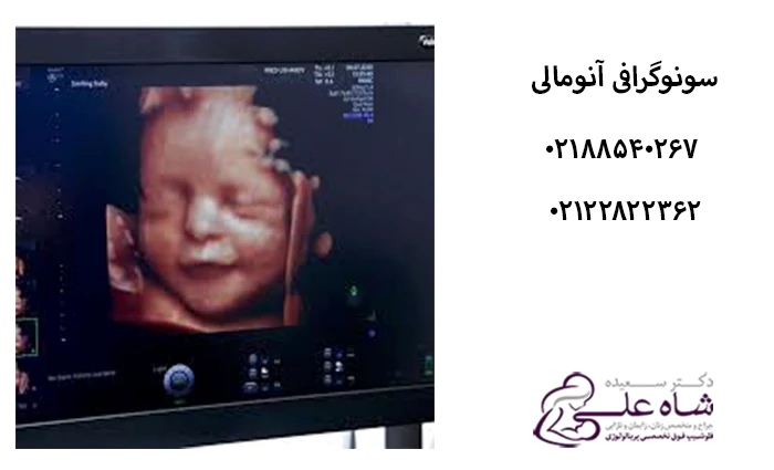 بهترین دکتر برای سونوگرافی انومالی