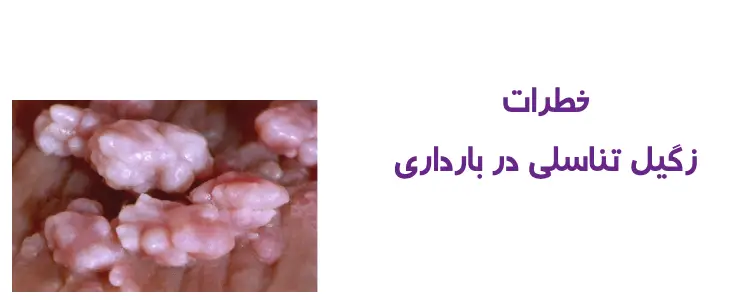 خطرات زگیل تناسلی در بارداری