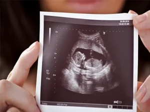 غربالگری جنین
