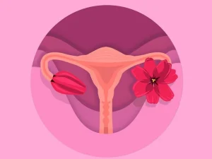 جراحی کیست تخمدان و آنجه باید درباره آن بدانید