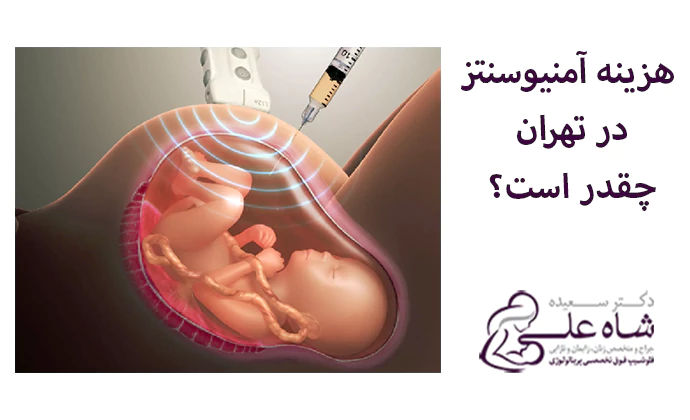 هزینه آمنیوسنتز در تهران