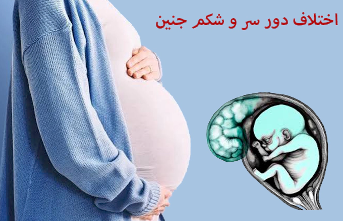 اختلاف دور سر و شکم جنین