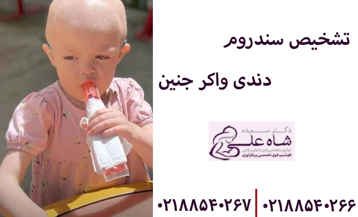 تشخیص سندروم دندی واکر