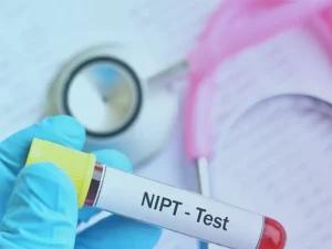 تست nipt در تهران